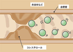 加圧トレーニング Top Fit